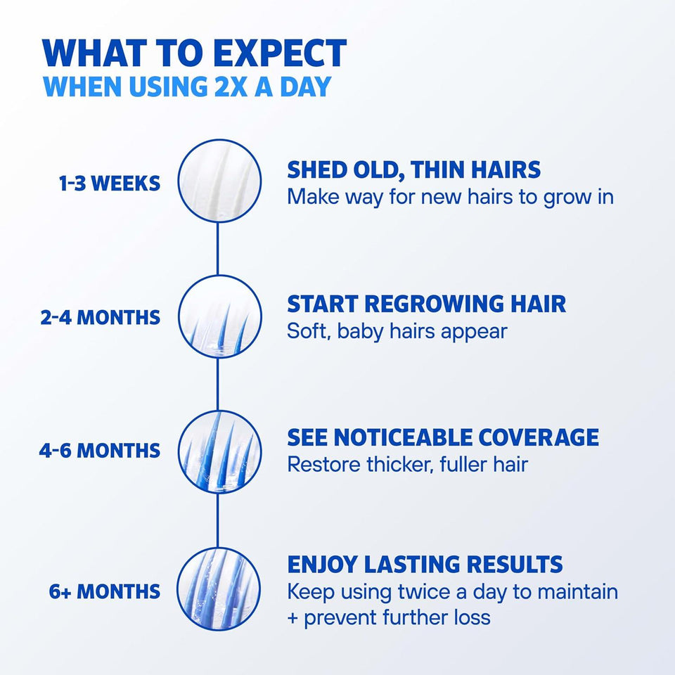 Rogaine Extra Strength Mens Hair Regrowth Treatment 1 Month